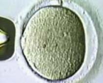 Blastocyst culture 2