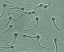 Video Morphology of the Sperm describing the different parts of the sperm