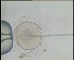 IVF and ICSI Photos 2