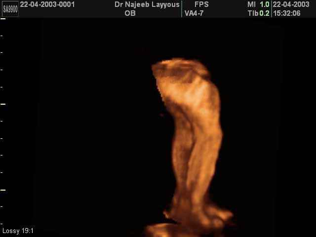 Lower limbs 22 weeks