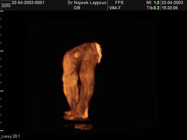 Lower limbs 22 weeks