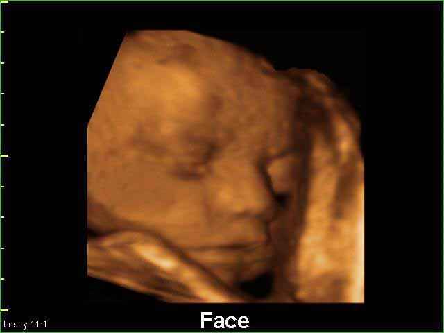 fetal face