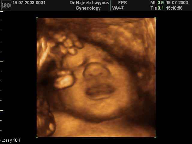 fetal face